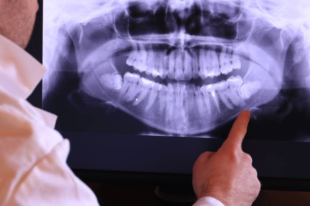 Best After-Hours Dental Care in Columbia, CA